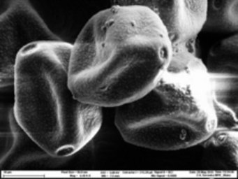 Hazel pollen often causes allergies as early as February since the plant flowers early in the year. The electron microscopic picture of hazel pollen was taken at the Max Planck Institute for Chemistry. Hazel pollen often causes allergies as early as February since the plant flowers early in the year. The electron microscopic picture of hazel pollen was taken at the Max Planck Institute for Chemistry.