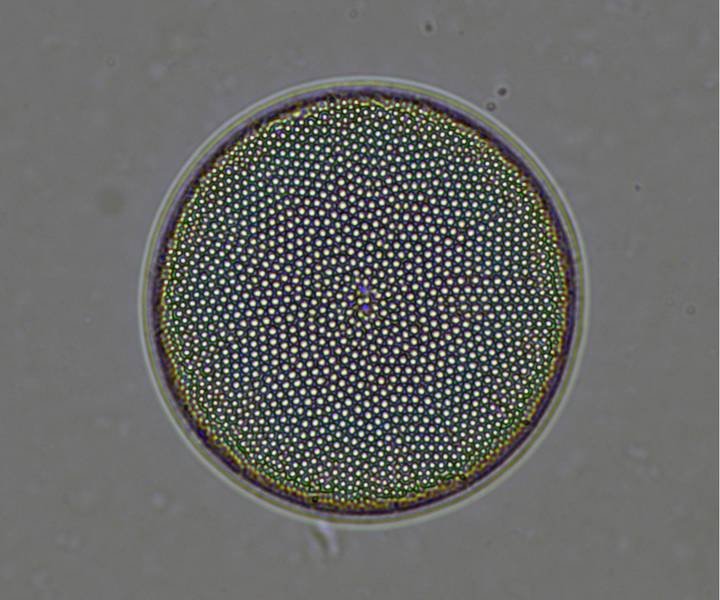 Close-up of a diatom under a microscope, showcasing a circular shape with a complex, symmetrical pattern of tiny dots arranged geometrically.