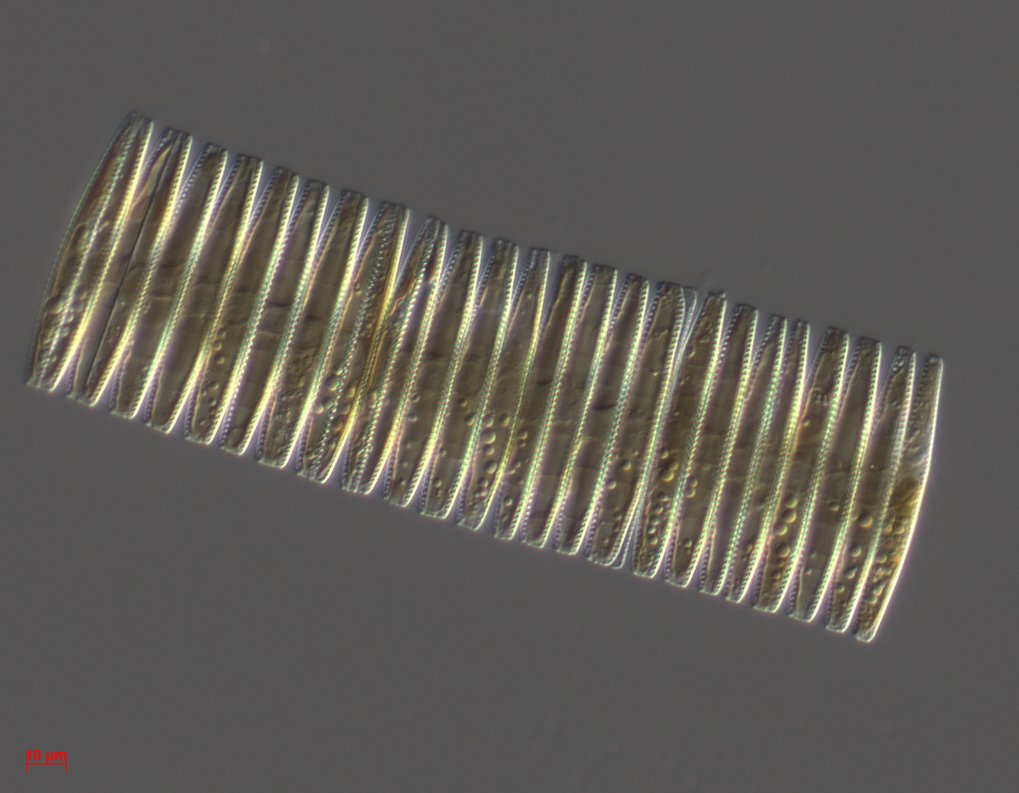 Anhand von Sedimentkernen aus dem Antarktischen Ozean erstellten die Forscher detaillierte Aufzeichnungen über die chemische Zusammensetzung der organischen Materie, die in den Fossilien von Kieselalgen eingeschlossen wurden. Im Bild zusehen ist eine lebende Kieselalge. Mikroskopische Aufnahme einer Kieselalge, die eine regelmäßige, gestreifte Struktur aufweist, mit feinen, parallelen Linien und subtilen Mustern im Inneren.