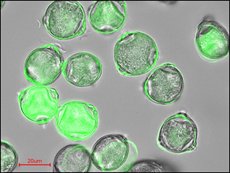 Fluoreszenzmikroskopische Aufnahme von Birkenpollen. Die Färbung zeigt Unterschiede in der chemischen Zusammensetzung der Pollenkörner, die im Inneren und an der Oberfläche allergieauslösende Proteine enthalten können.