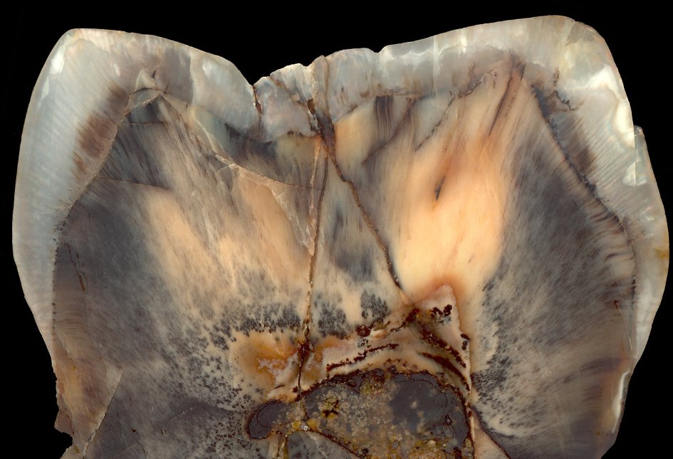 Picture of a Paleo tooth