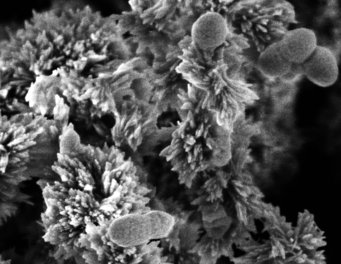 Winzige Beeinflusser der Luftreinigung: Nicht einmal einen Mikrometer, einen Tausendstel Millimeter, werden die Ammoniak-oxidierenden Bakterien mit ihrer kugeligen oder erdnussförmigen Gestalt groß. Aus trockenen und neutral bis alkalischen Böden geben sie HONO in die Atmosphäre ab.  Winzige Beeinflusser der Luftreinigung: Nicht einmal einen Mikrometer, einen Tausendstel Millimeter, werden die Ammoniak-oxidierenden Bakterien mit ihrer kugeligen oder erdnussförmigen Gestalt groß. Aus trockenen und neutral bis alkalischen Böden geben sie HONO in die Atmosphäre ab.