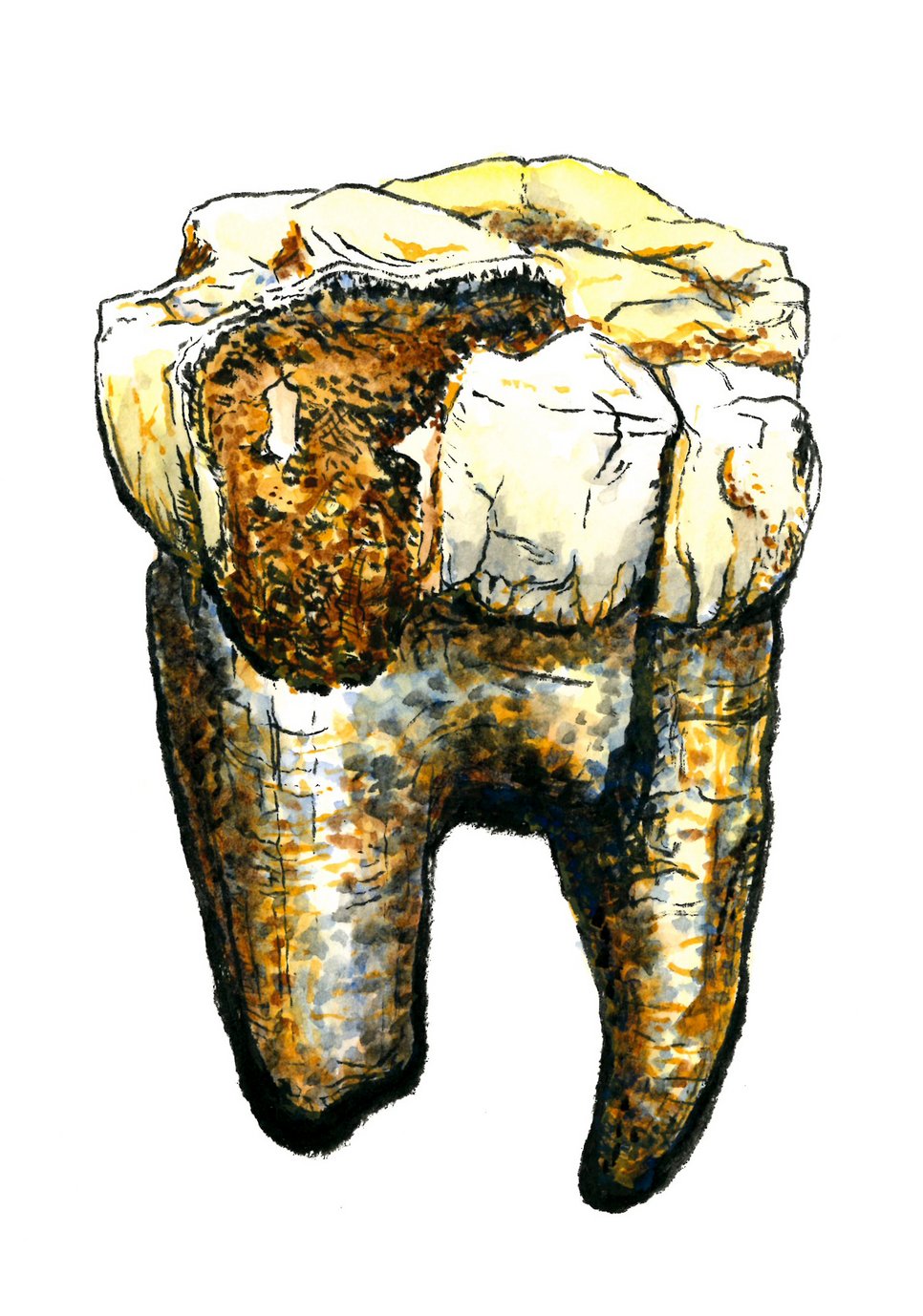 Handgezeichnete Darstellung einer der sieben beprobten Backenzähne (StW-148) von Australopithecus. 