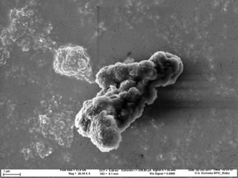 Electron microscope image of a soot particle composed of carbon nanoparticles. Electron microscope image showing clustered dust particles on a surface.